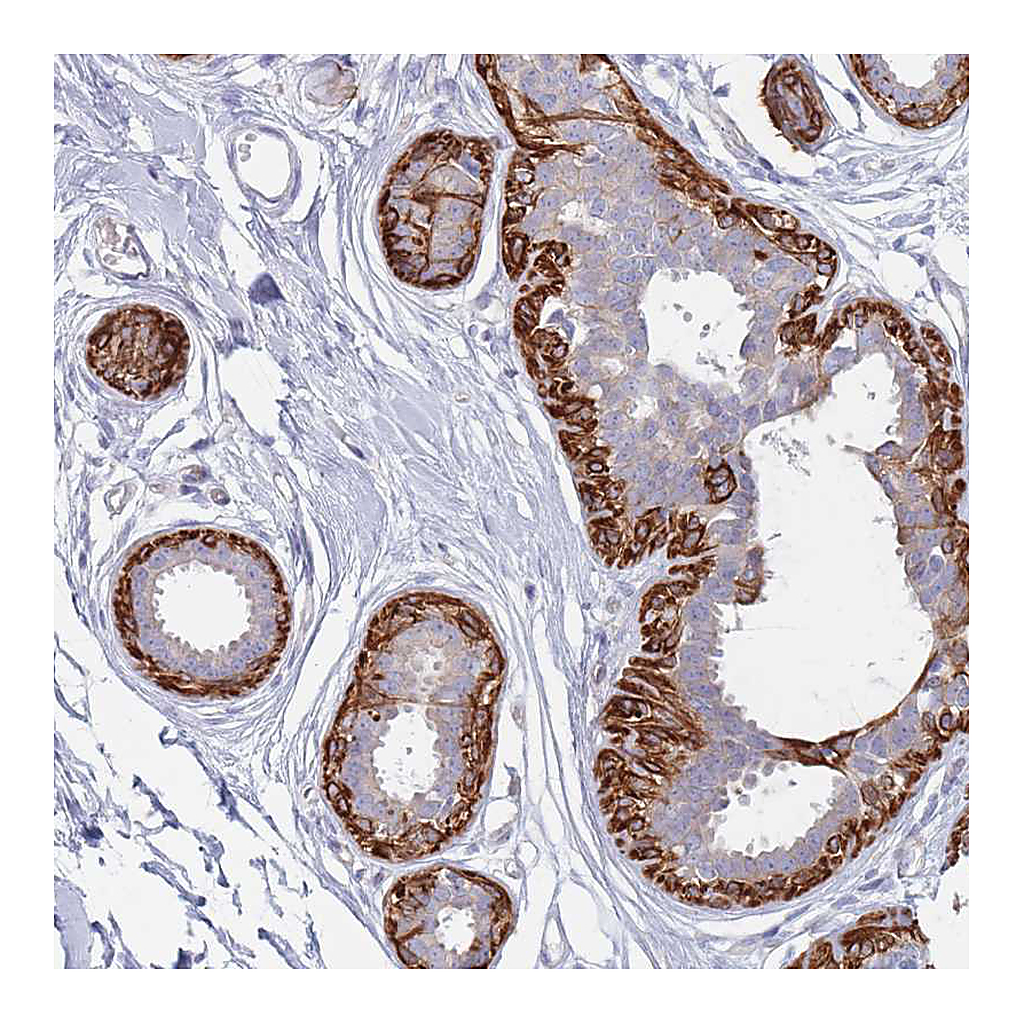 Atlas Antibodies Anti-ERBIN Antibody