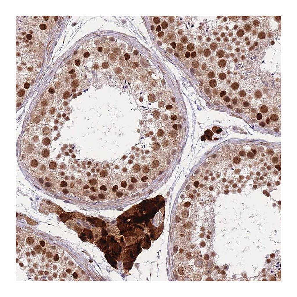 Atlas Antibodies Anti-ERCC2 Antibody