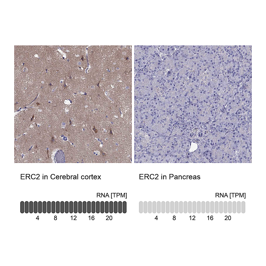 Atlas Antibodies Anti-ERC2 Antibody