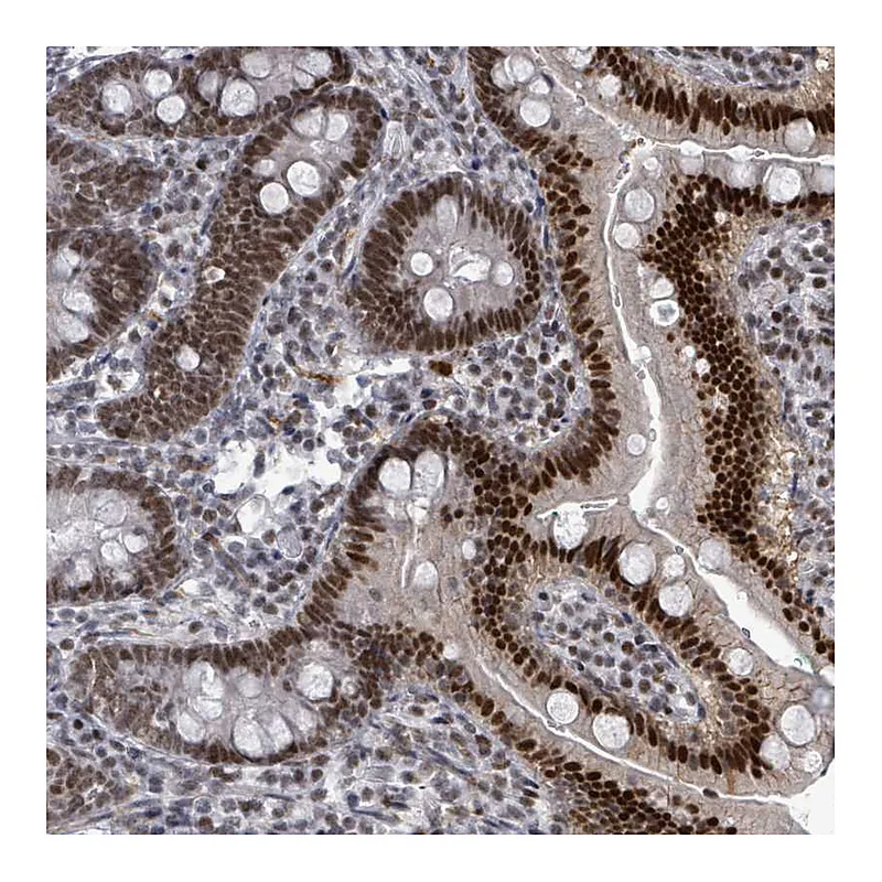 Atlas Antibodies Anti-ERCC5 Antibody