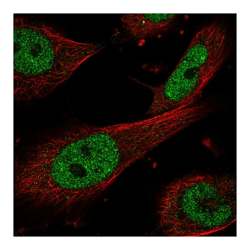 Atlas Antibodies Anti-ERCC1 Antibody