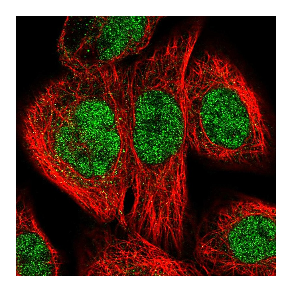 Atlas Antibodies Anti-ERCC3 Antibody