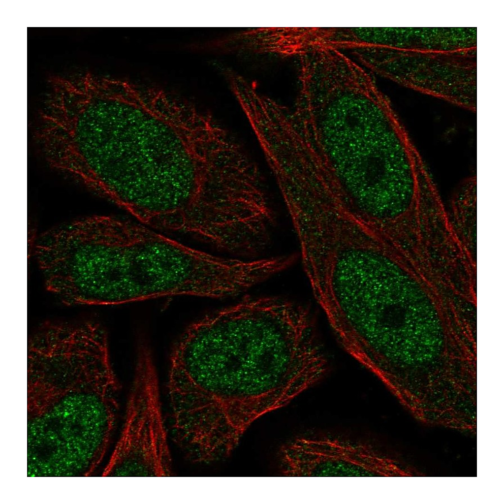 Atlas Antibodies Anti-ERCC2 Antibody