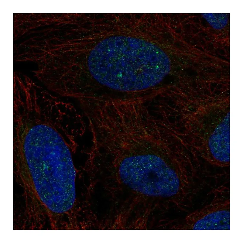 Atlas Antibodies Anti-ERCC6 Antibody