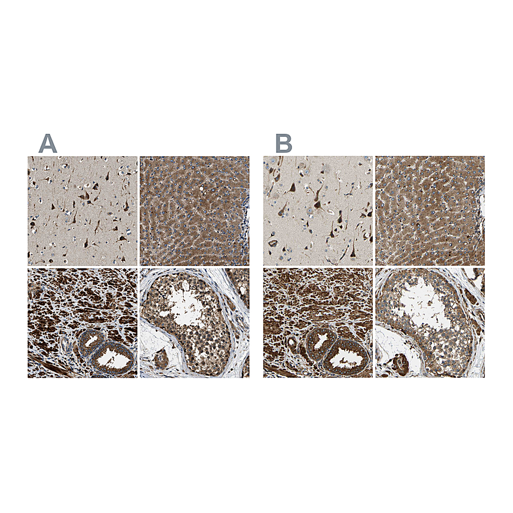 Atlas Antibodies Anti-ERGIC1 Antibody