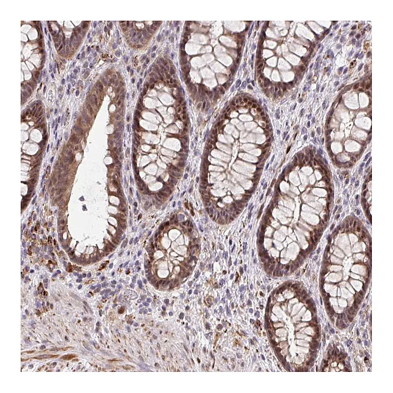 Atlas Antibodies Anti-ERG Antibody