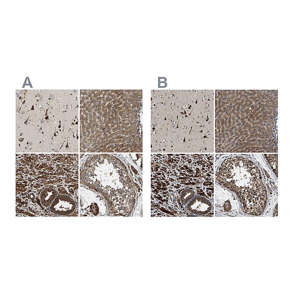 Atlas Antibodies Anti-ERGIC1 Antibody