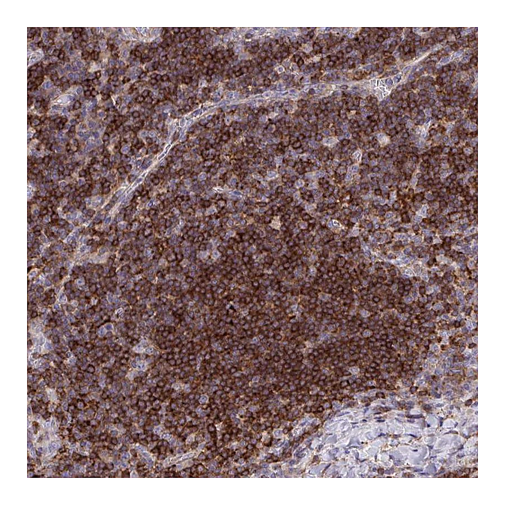 Atlas Antibodies Anti-ERI1 Antibody