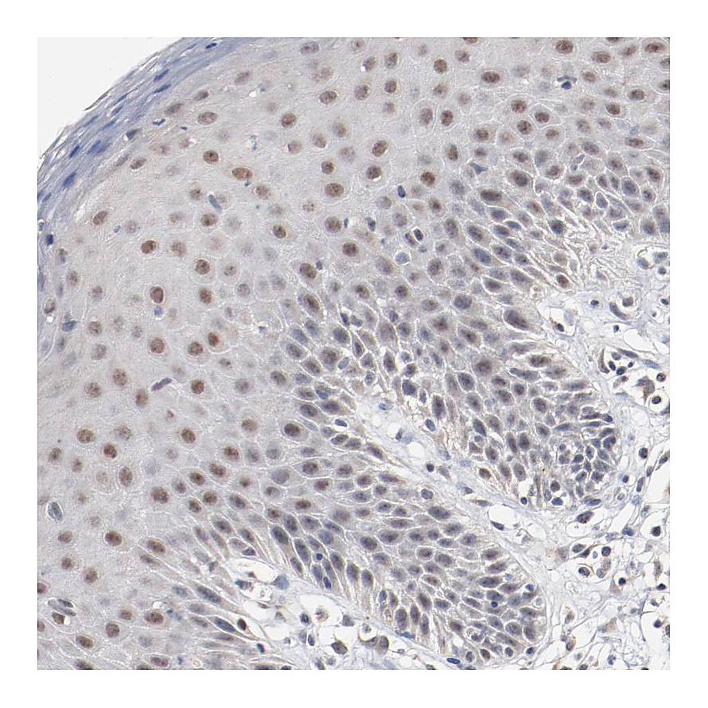 Atlas Antibodies Anti-ERICH1 Antibody