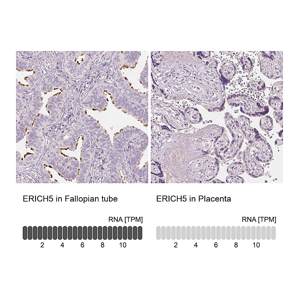 Atlas Antibodies Anti-ERICH5 Antibody