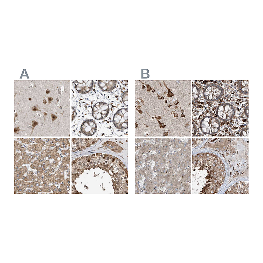 Atlas Antibodies Anti-ERLEC1 Antibody