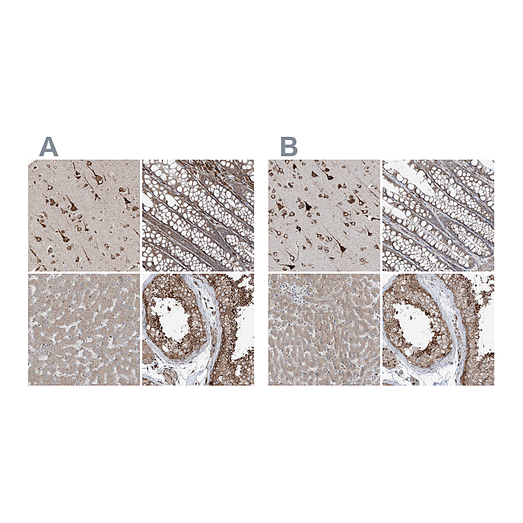 Atlas Antibodies Anti-ERLEC1 Antibody