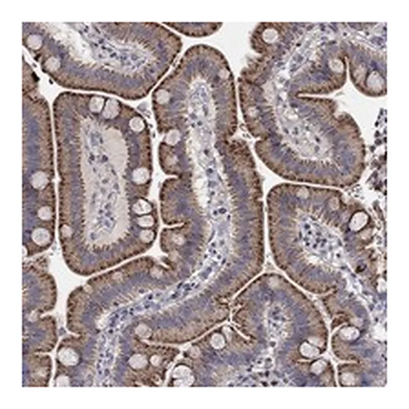 Atlas Antibodies Anti-ERN2 Antibody
