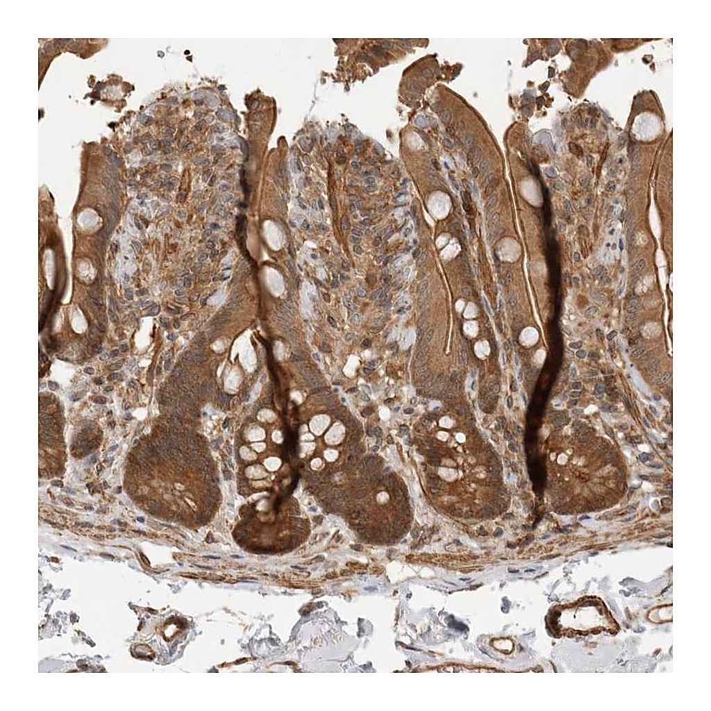 Atlas Antibodies Anti-ERN1 Antibody
