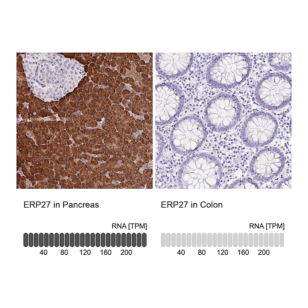 Atlas Antibodies Anti-ERP27 Antibody