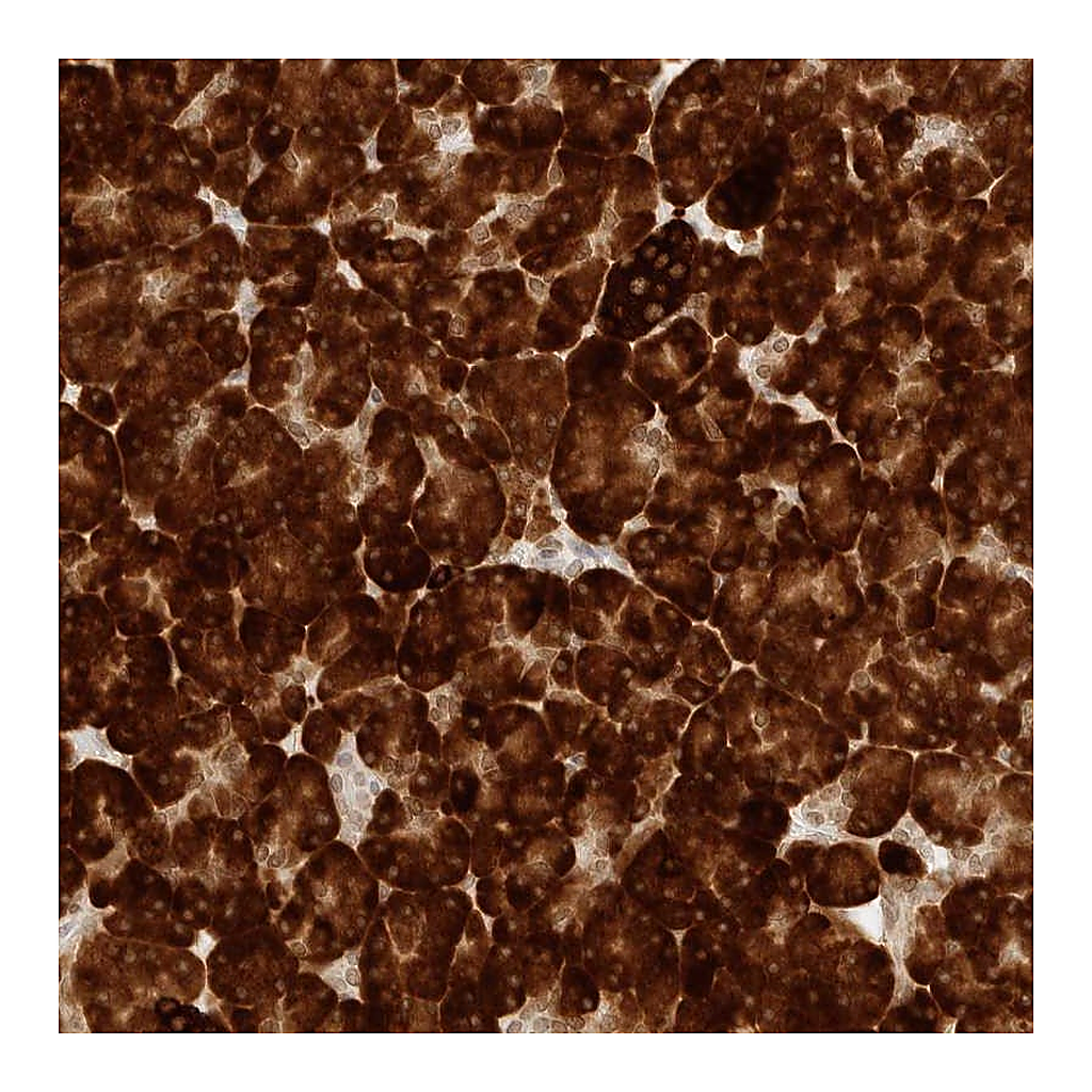 Atlas Antibodies Anti-ERO1B Antibody