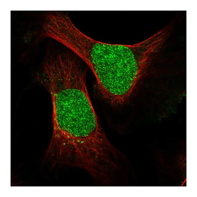 Atlas Antibodies Anti-ESCO2 Antibody