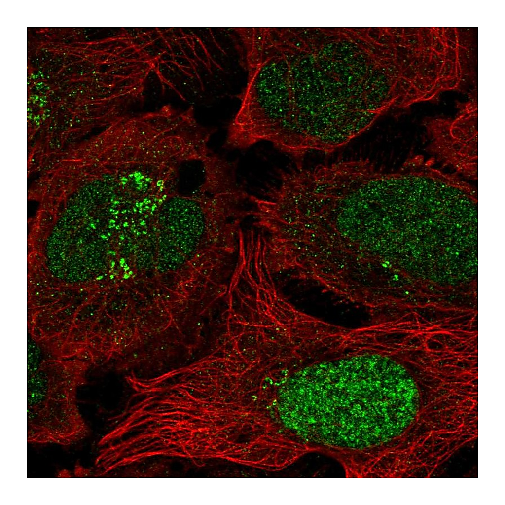 Atlas Antibodies Anti-ESCO2 Antibody