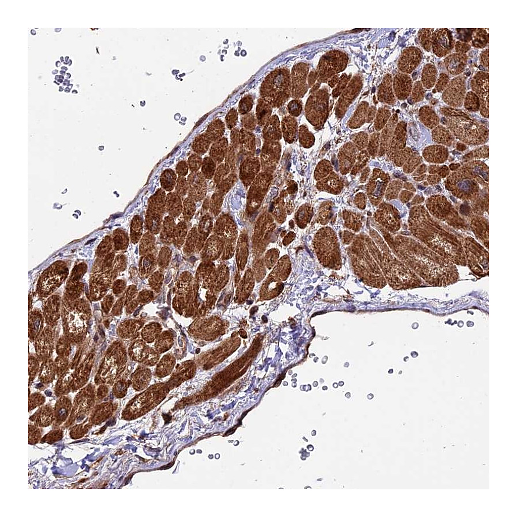 Atlas Antibodies Anti-ESCO1 Antibody