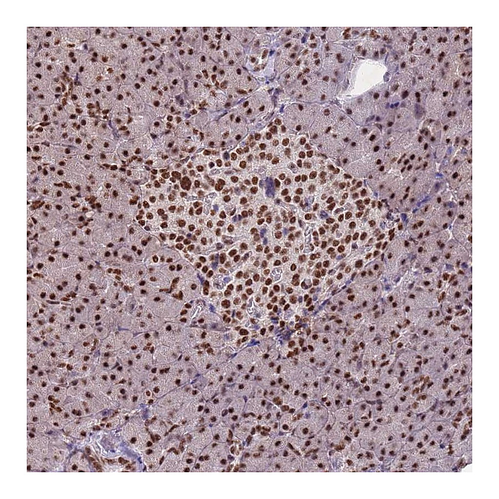 Atlas Antibodies Anti-ESF1 Antibody
