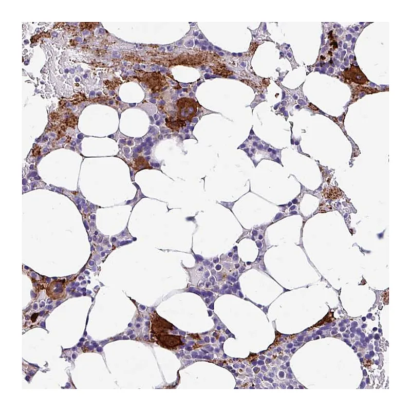 Atlas Antibodies Anti-ESPNL Antibody