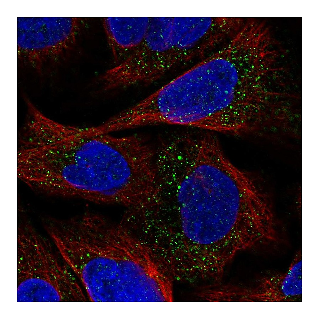 Atlas Antibodies Anti-ESPN Antibody