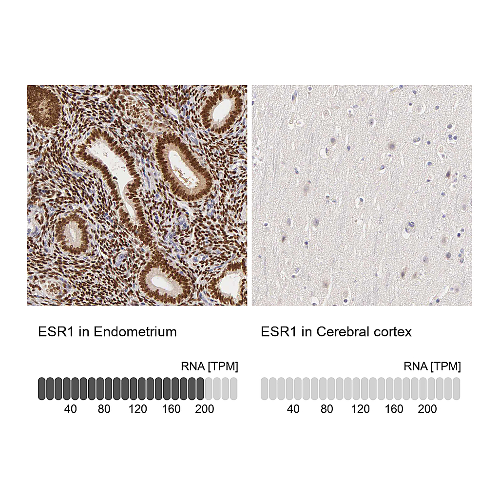 Atlas Antibodies Anti-ESR1 Antibody