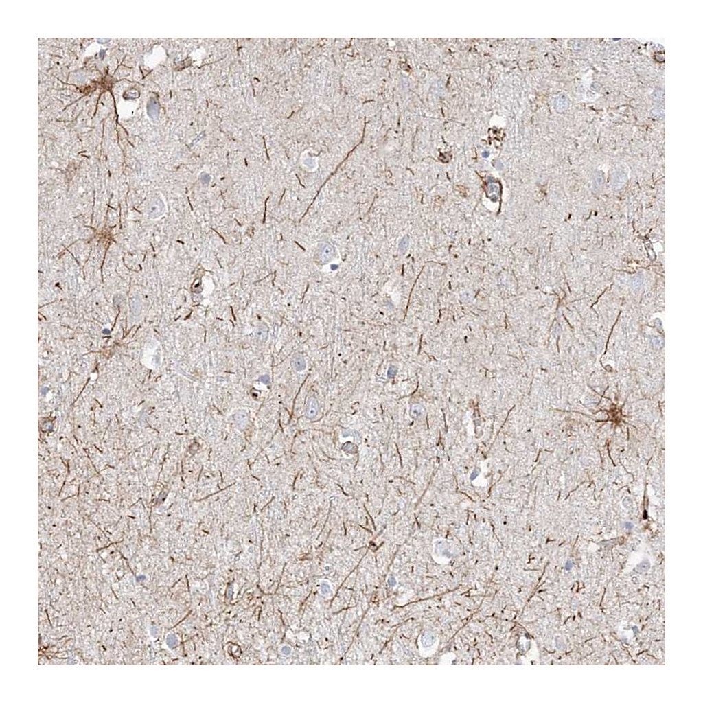 Atlas Antibodies Anti-ETAA1 Antibody