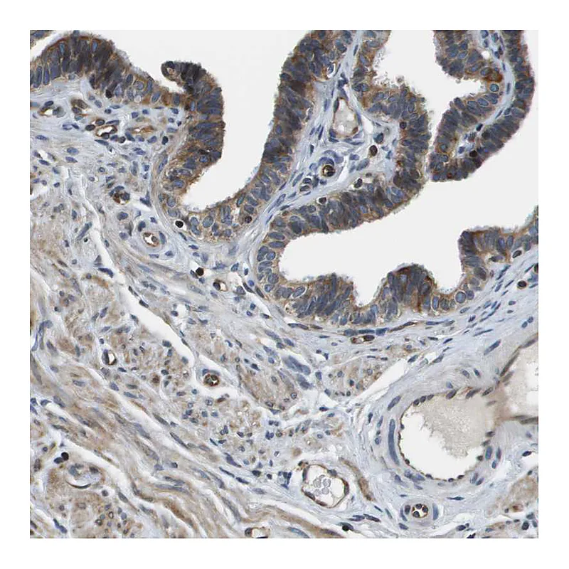 Atlas Antibodies Anti-ESYT1 Antibody