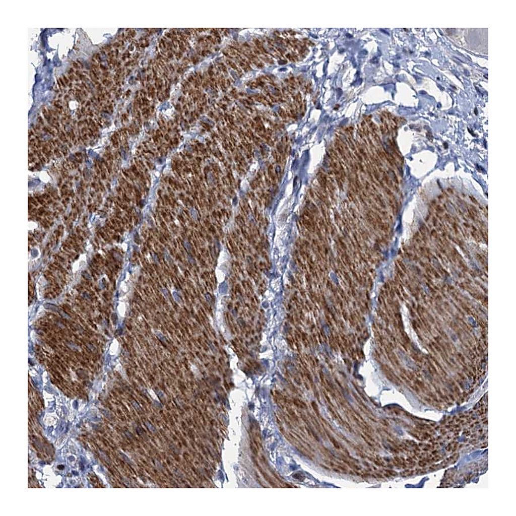 Atlas Antibodies Anti-ESYT3 Antibody