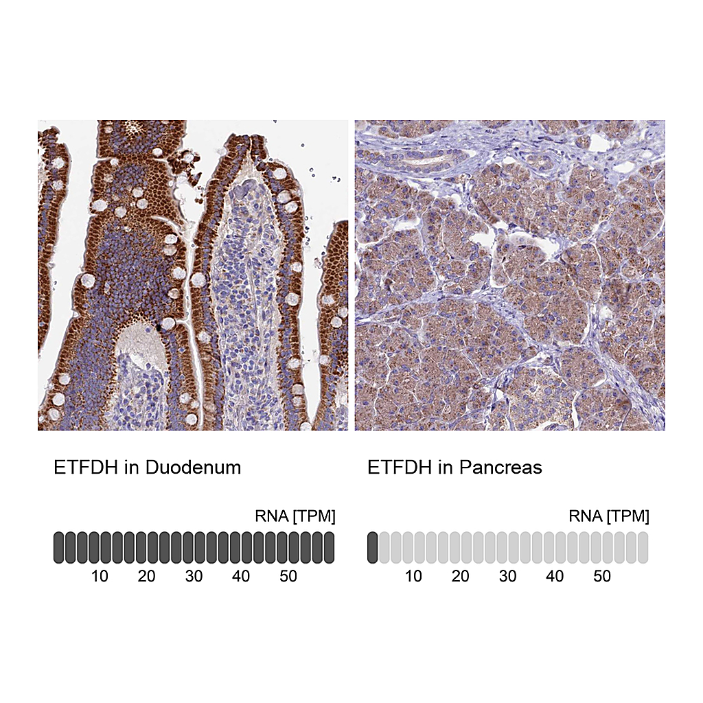 Atlas Antibodies Anti-ETFDH Antibody
