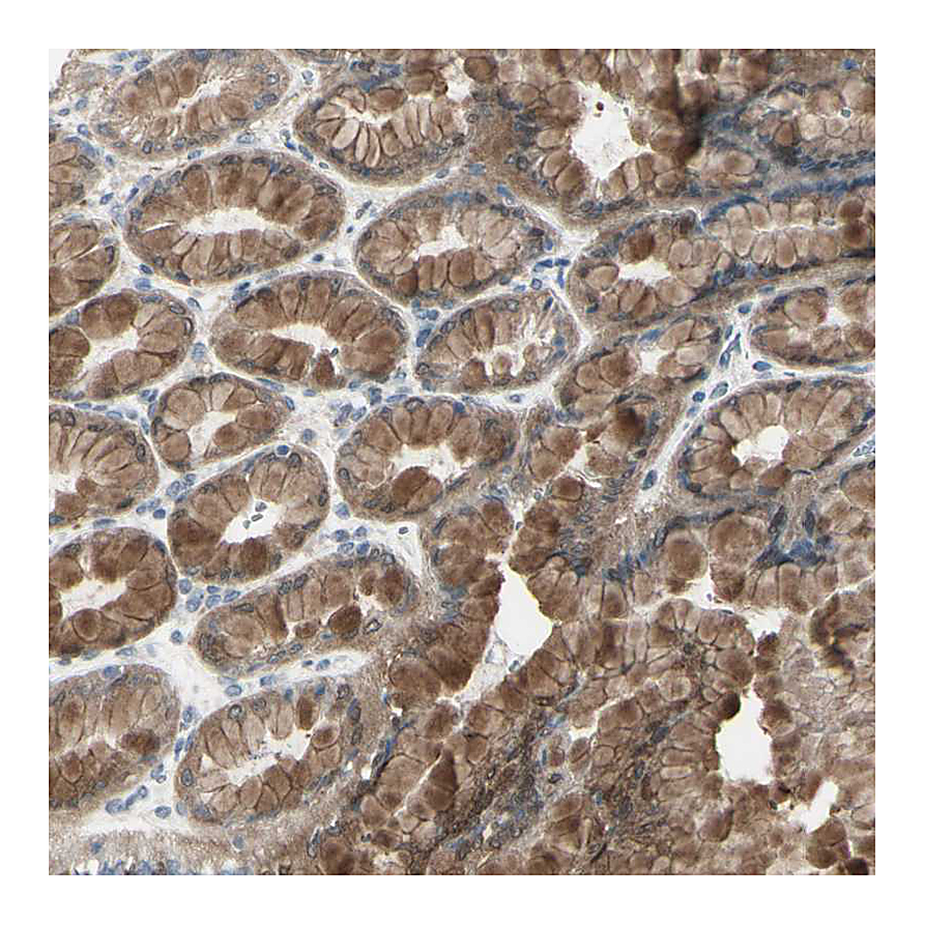 Atlas Antibodies Anti-ETNK1 Antibody