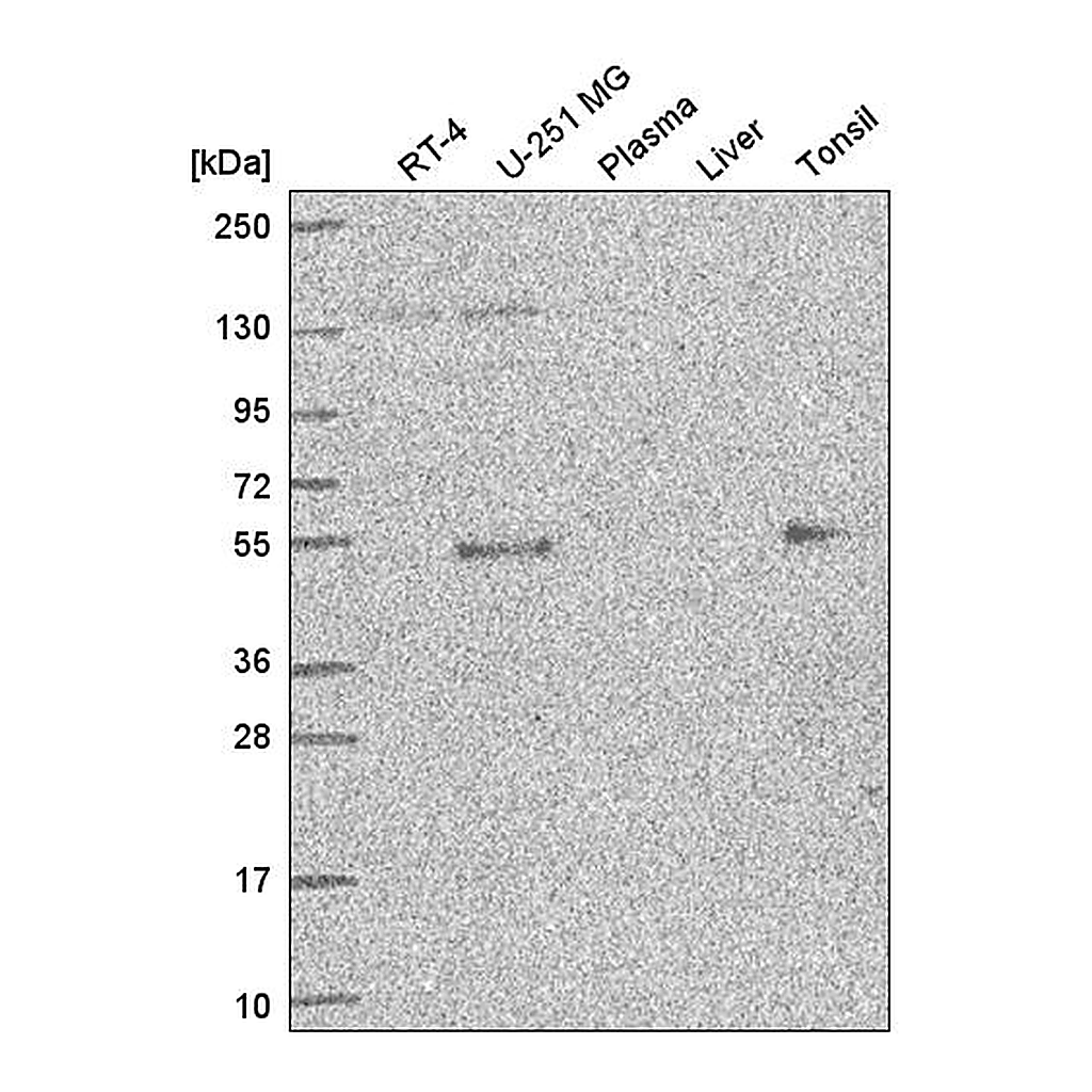 Atlas Antibodies Anti-ETS1 Antibody