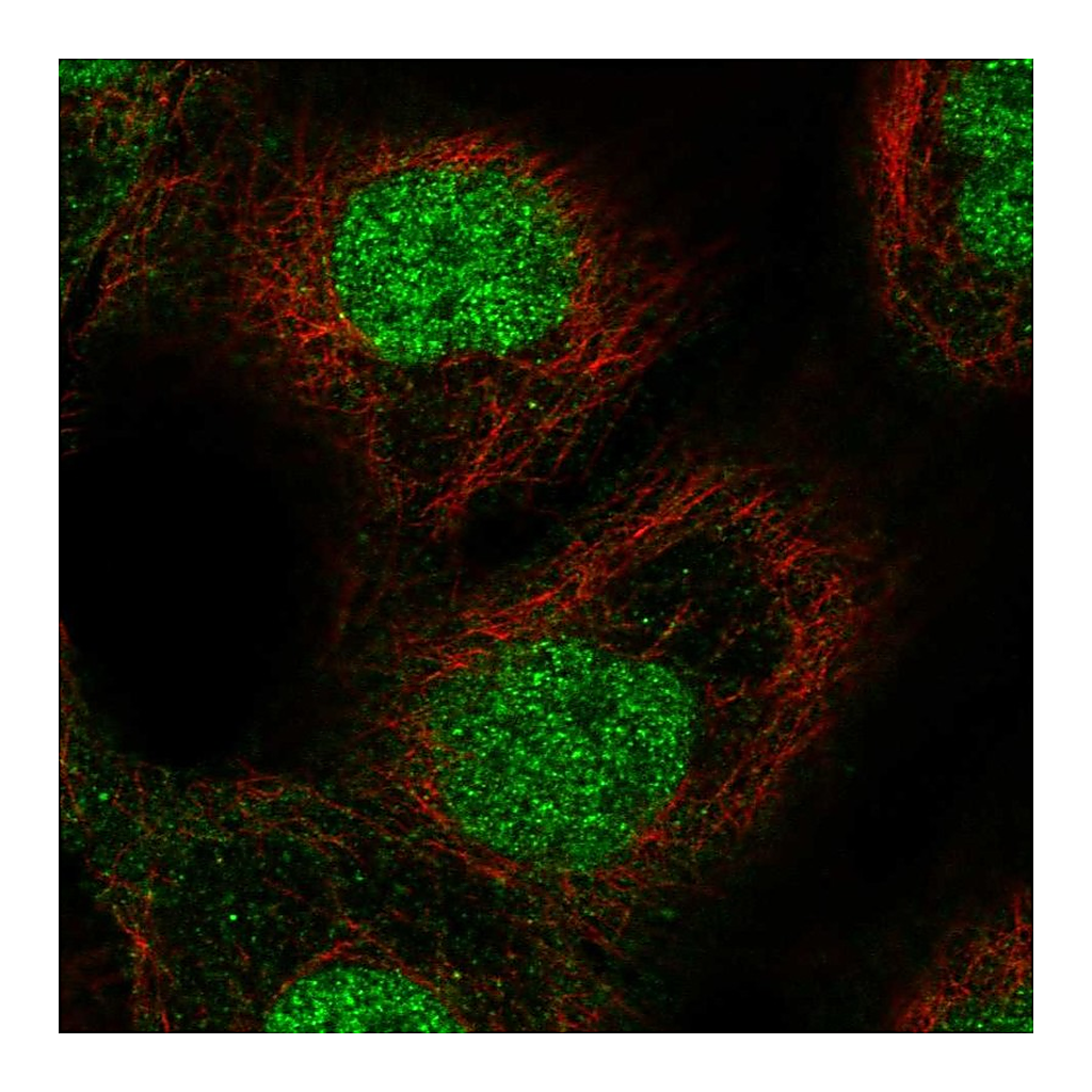Atlas Antibodies Anti-ETS2 Antibody