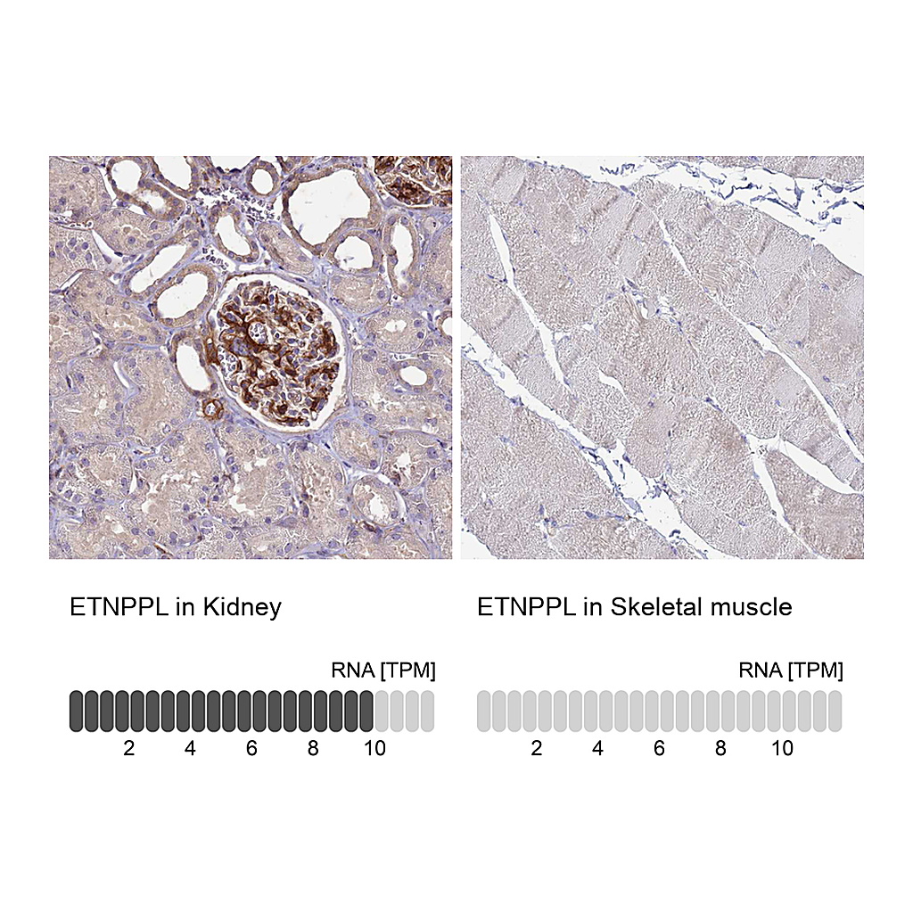 Atlas Antibodies Anti-ETNPPL Antibody