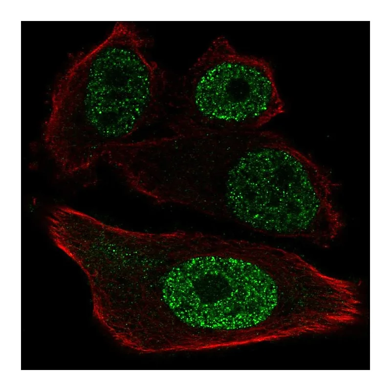 Atlas Antibodies Anti-ETV1 Antibody