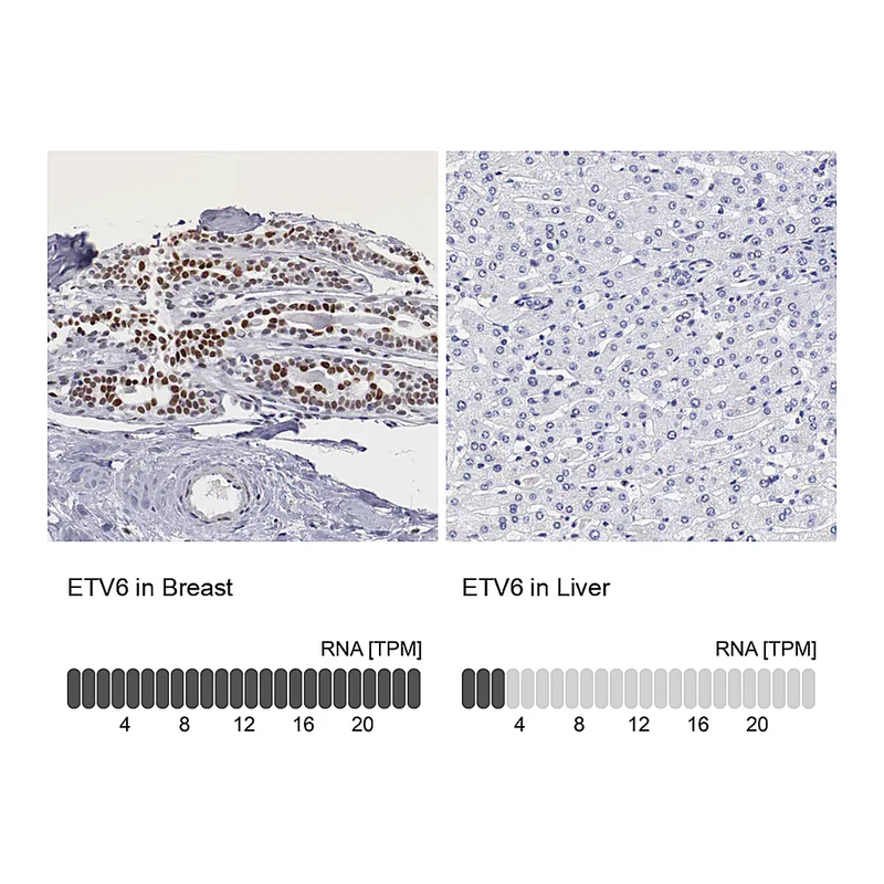 Atlas Antibodies Anti-ETV6 Antibody