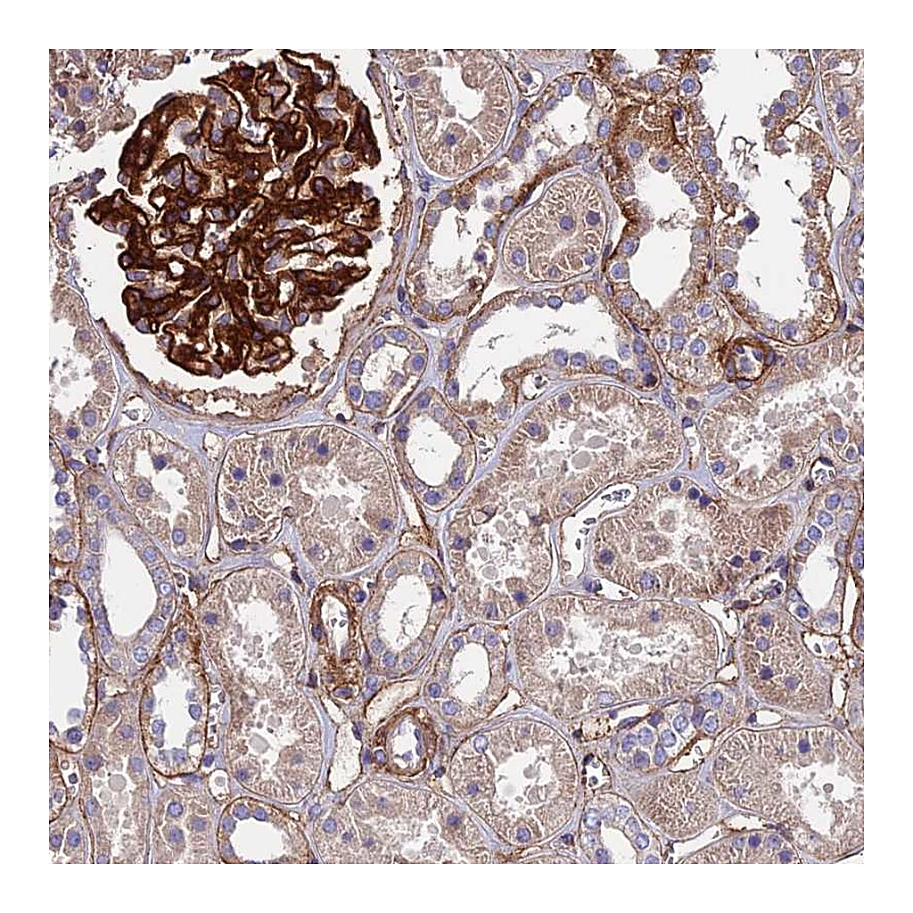 Atlas Antibodies Anti-EVA1B Antibody