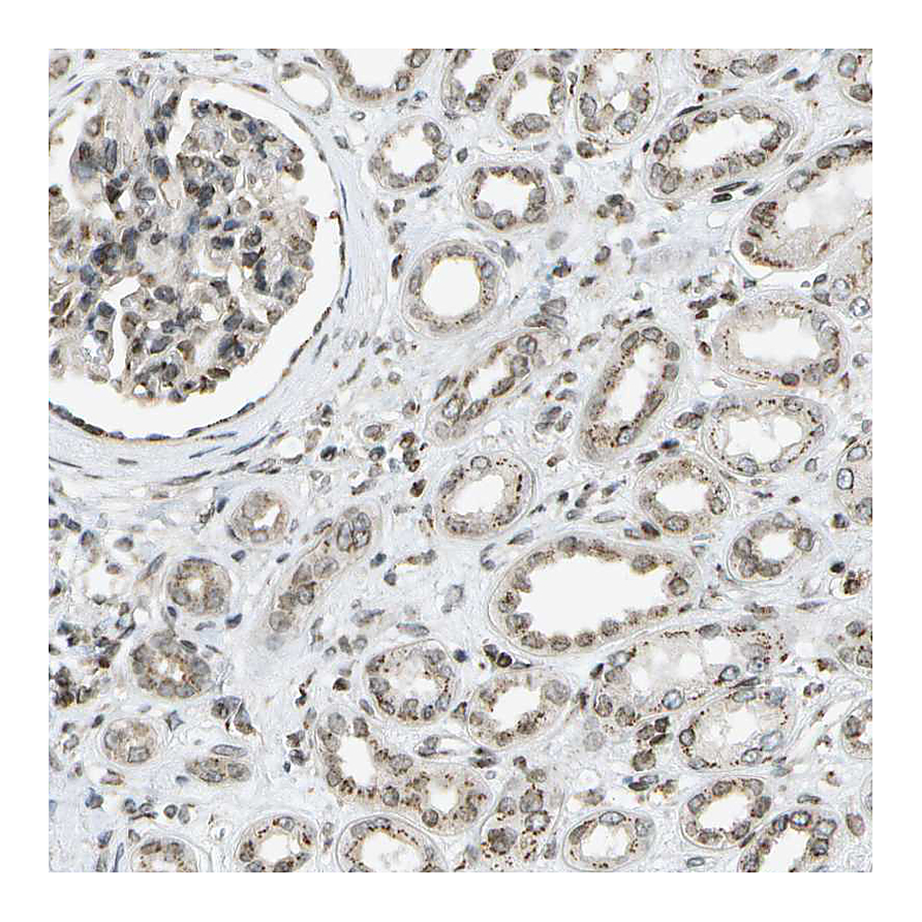 Atlas Antibodies Anti-EVC Antibody