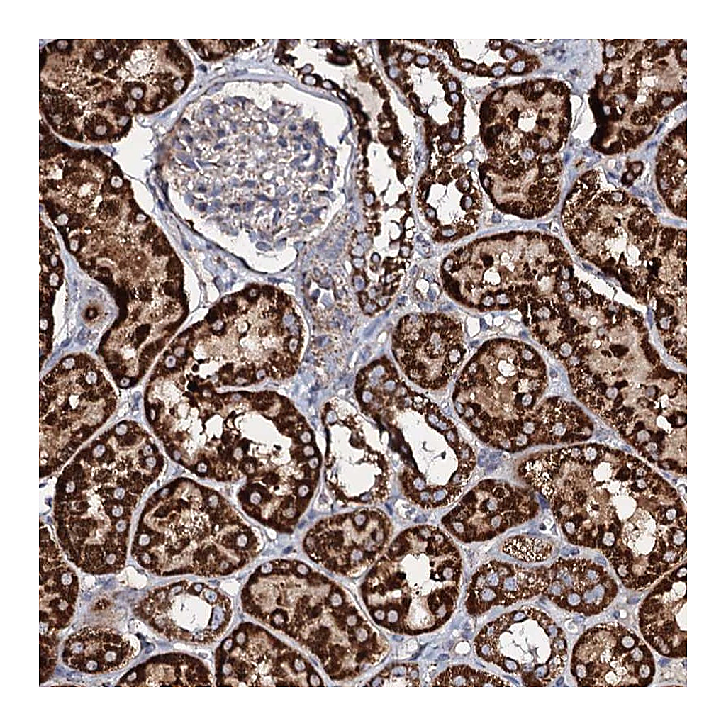 Atlas Antibodies Anti-EVC2 Antibody