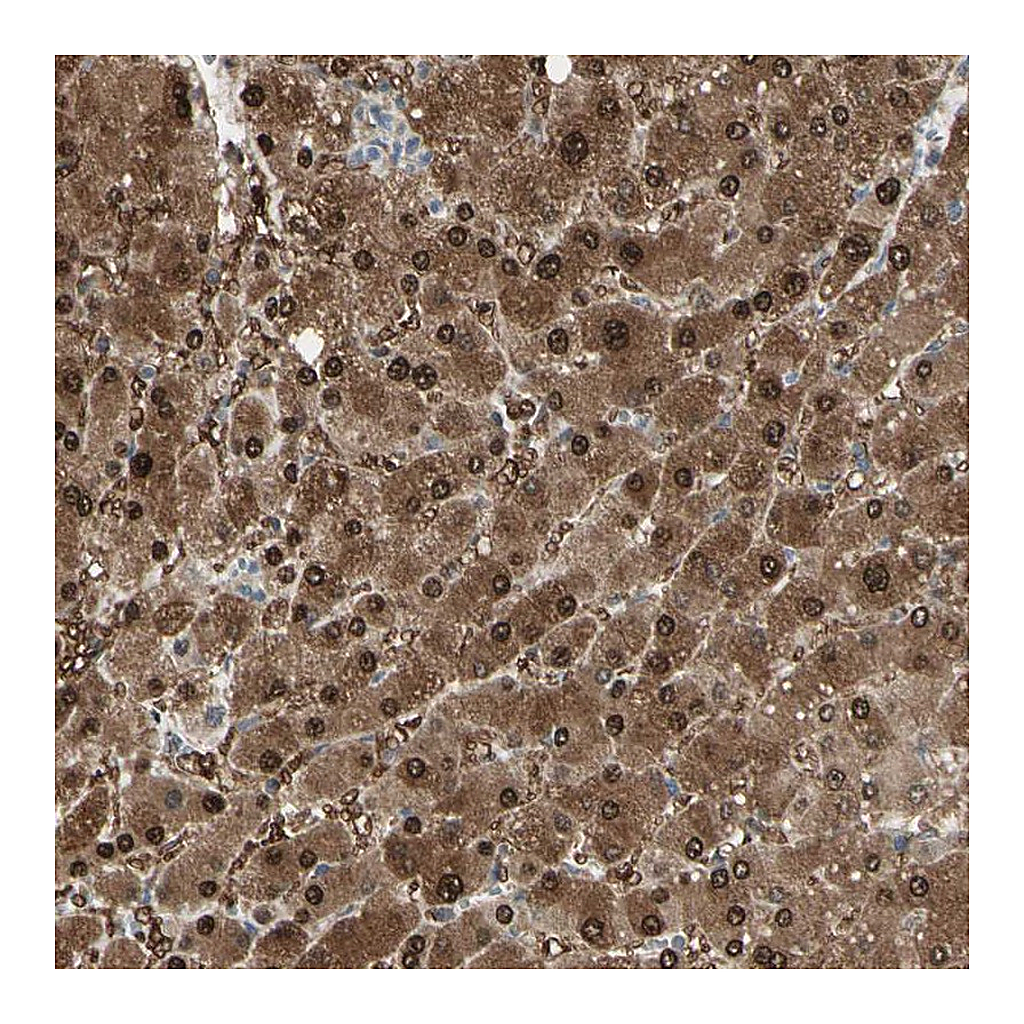 Atlas Antibodies Anti-EVC Antibody