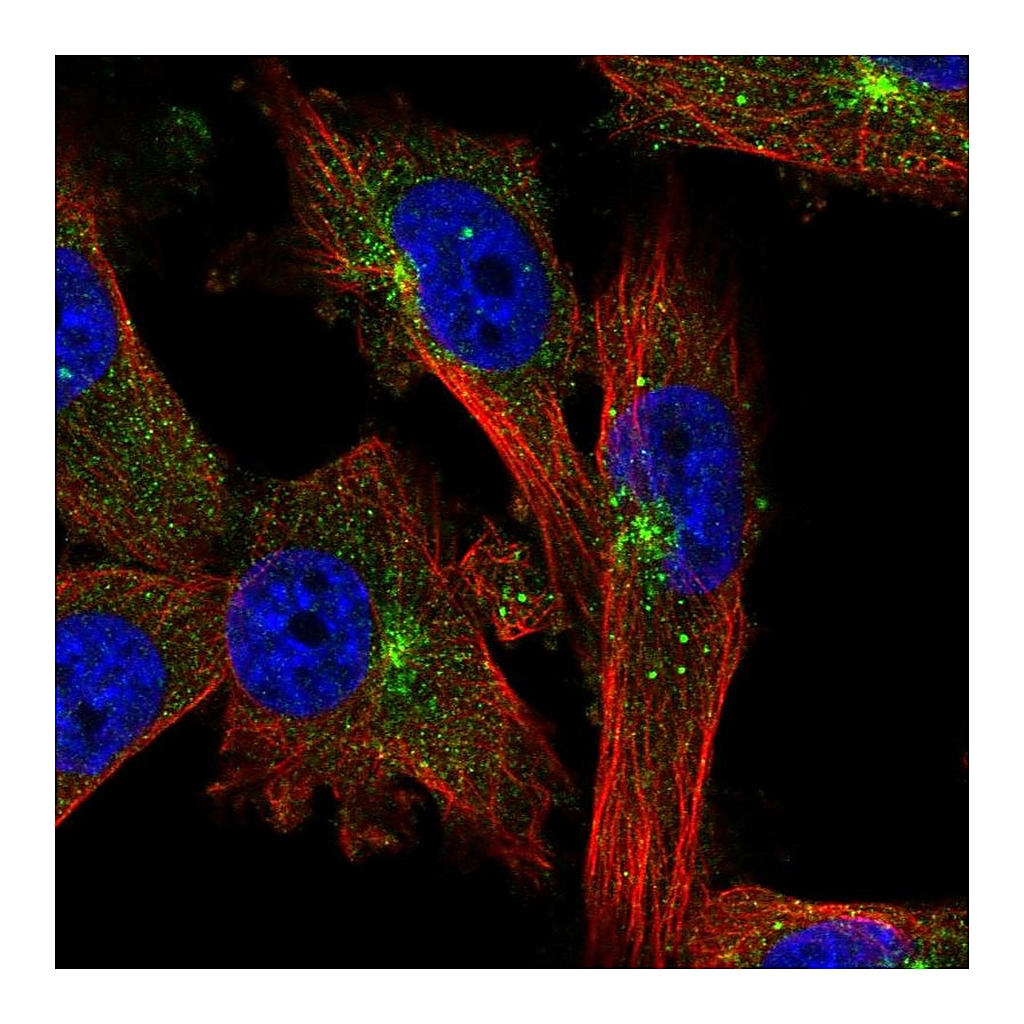 Atlas Antibodies Anti-EVI5 Antibody