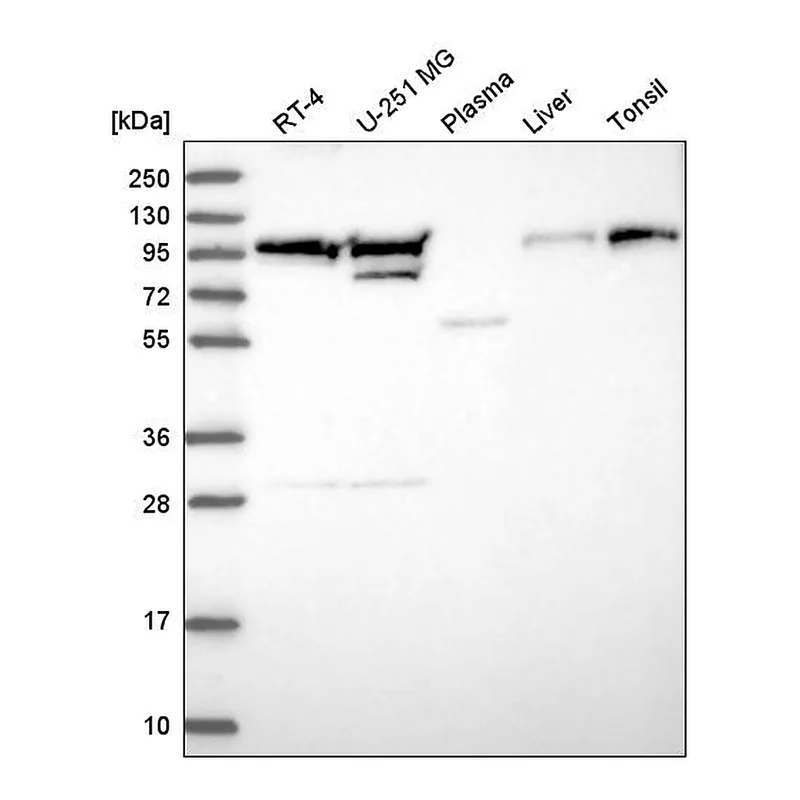 Atlas Antibodies Anti-EVI5L Antibody