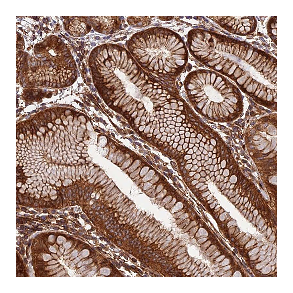 Atlas Antibodies Anti-EVI5L Antibody