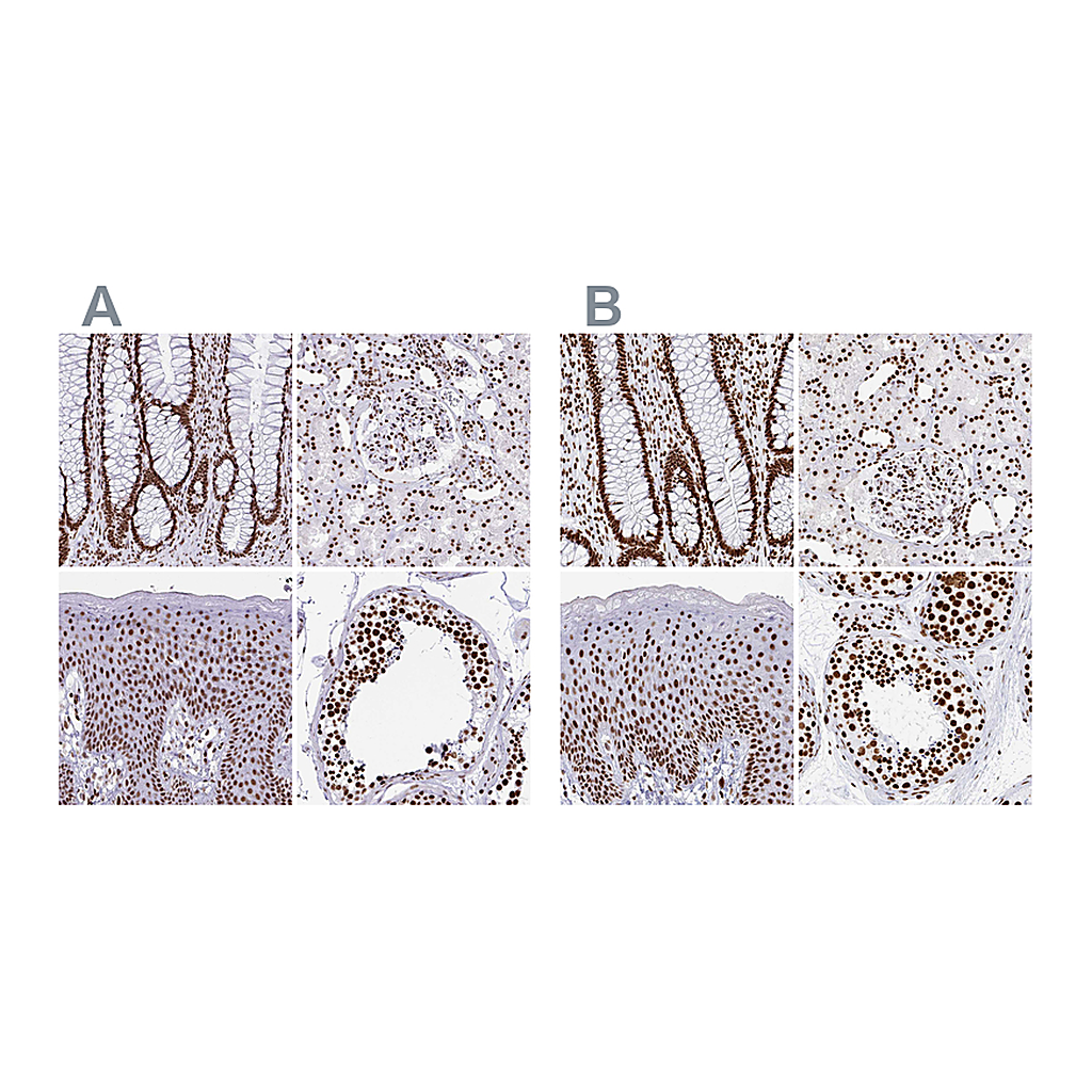 Atlas Antibodies Anti-EWSR1 Antibody