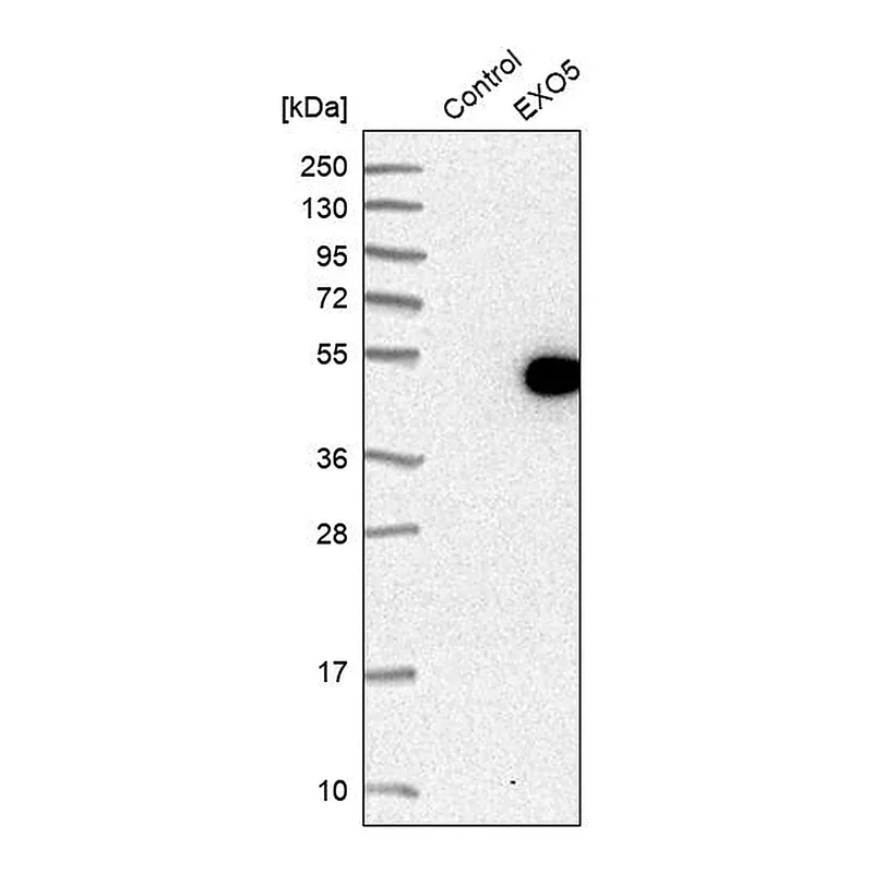 Atlas Antibodies Anti-EXO5 Antibody