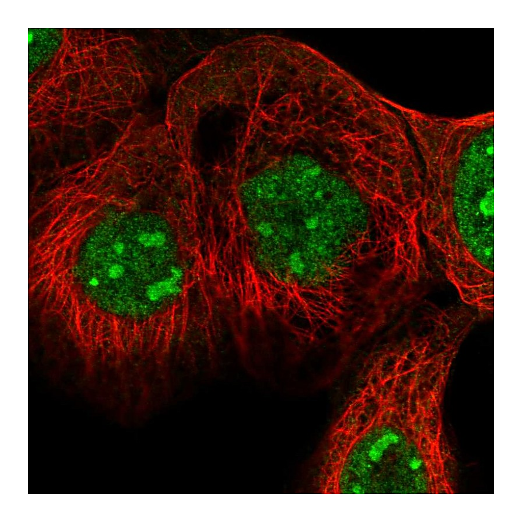 Atlas Antibodies Anti-EXOC4 Antibody