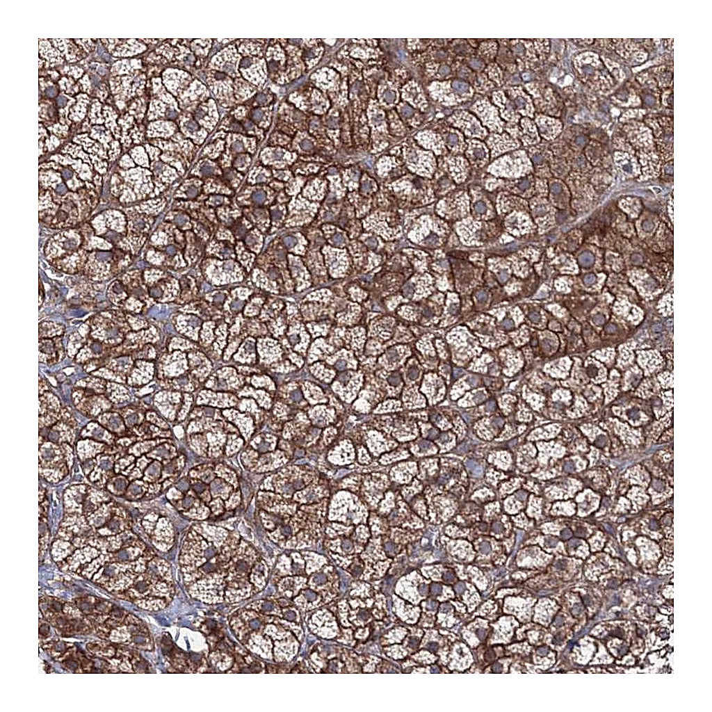 Atlas Antibodies Anti-EXOC6 Antibody
