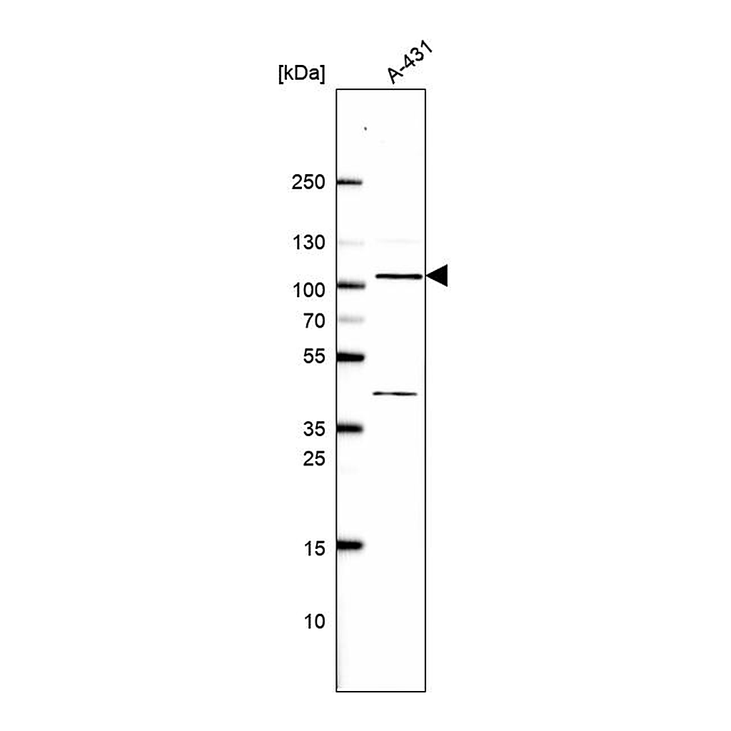 Atlas Antibodies Anti-EXOC6B Antibody