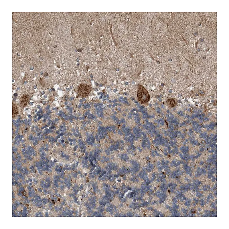 Atlas Antibodies Anti-EXOC8 Antibody